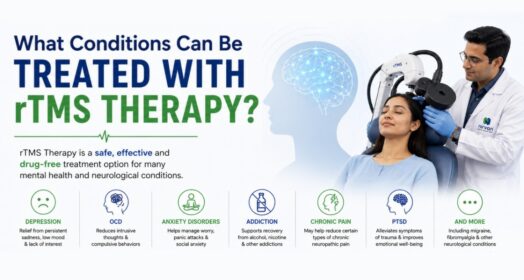 rTMS therapy