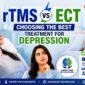rTMS vs ECT Choosing the Best Treatment for Depression 85x85