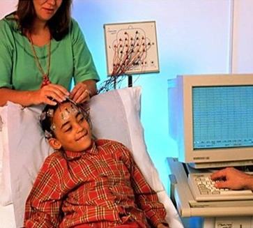 Electroencephalogram